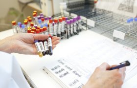 Bioingeniør i arbeid på preanalytisk prøvemottak. 